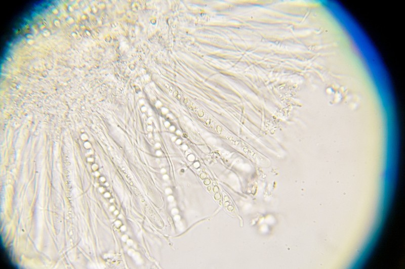 Trivial Absconditella Lichen