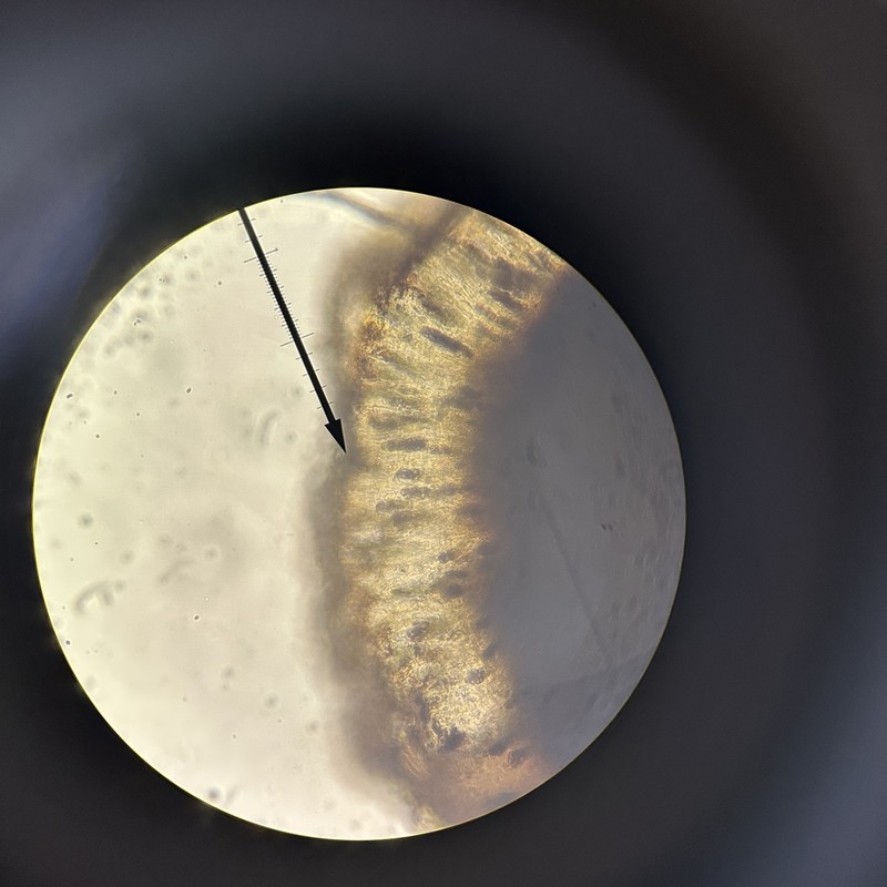 Amandinea polyspora photo 8