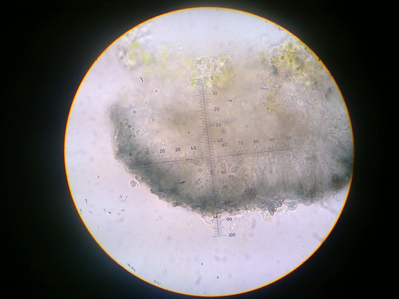 Arthonia muscigena photo 2