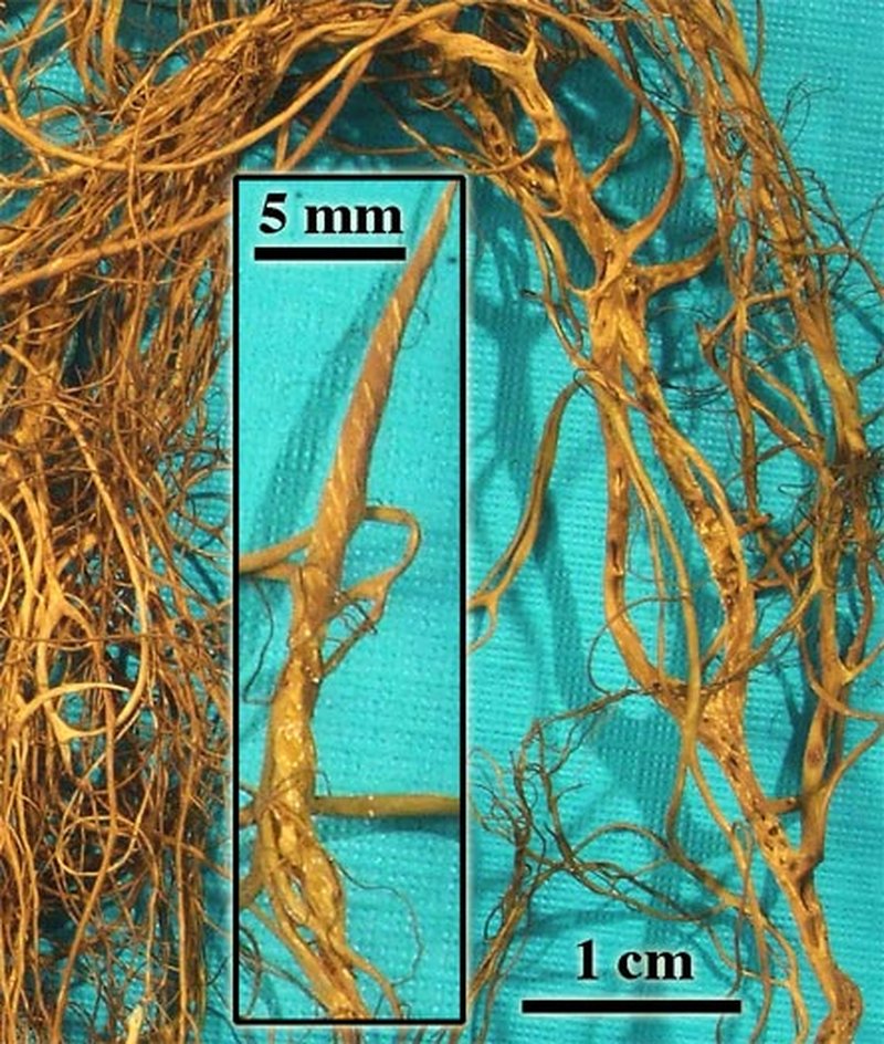 Tortured Horsehair Lichen