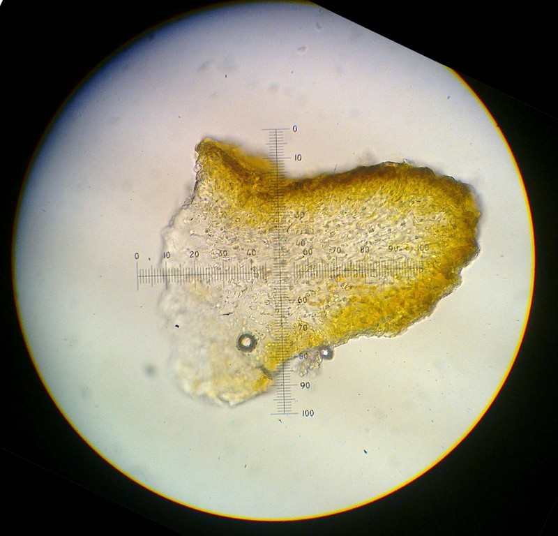 Jelly Lichen