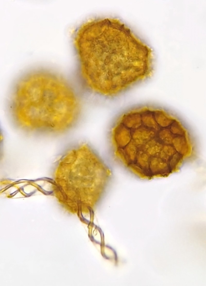 Fossombronia foveolata photo 8