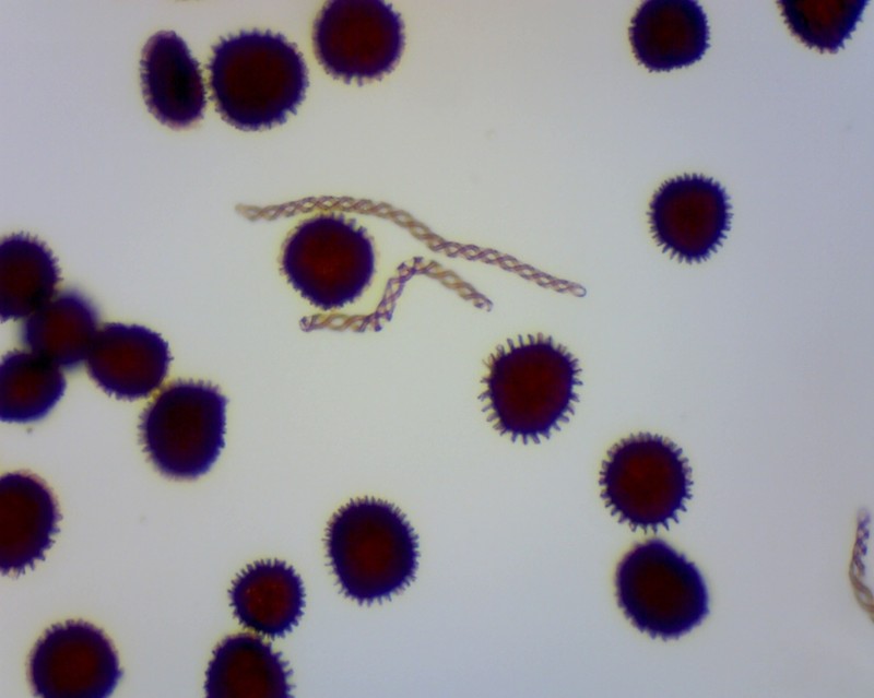 Fossombronia longiseta photo 2