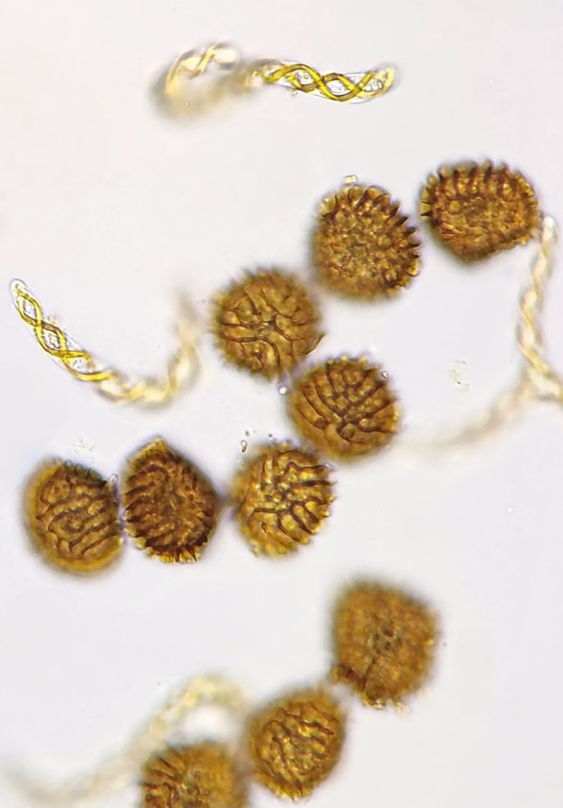 Fossombronia wondraczekii photo 3