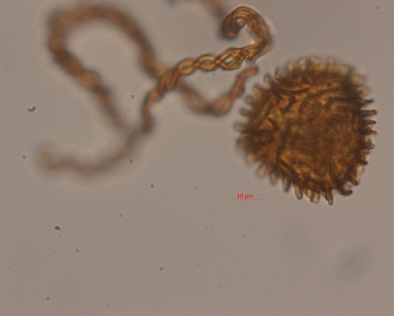Fossombronia wondraczekii photo 8