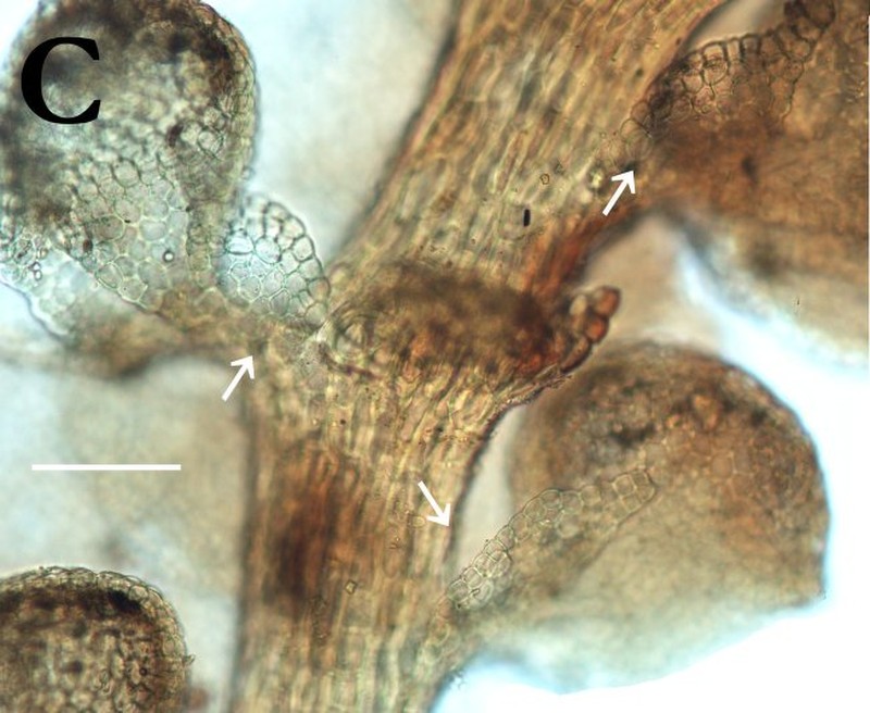 Frullania stylifera photo 2