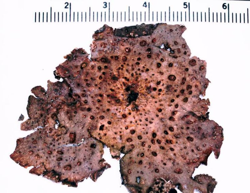 Blistered Naval Lichen