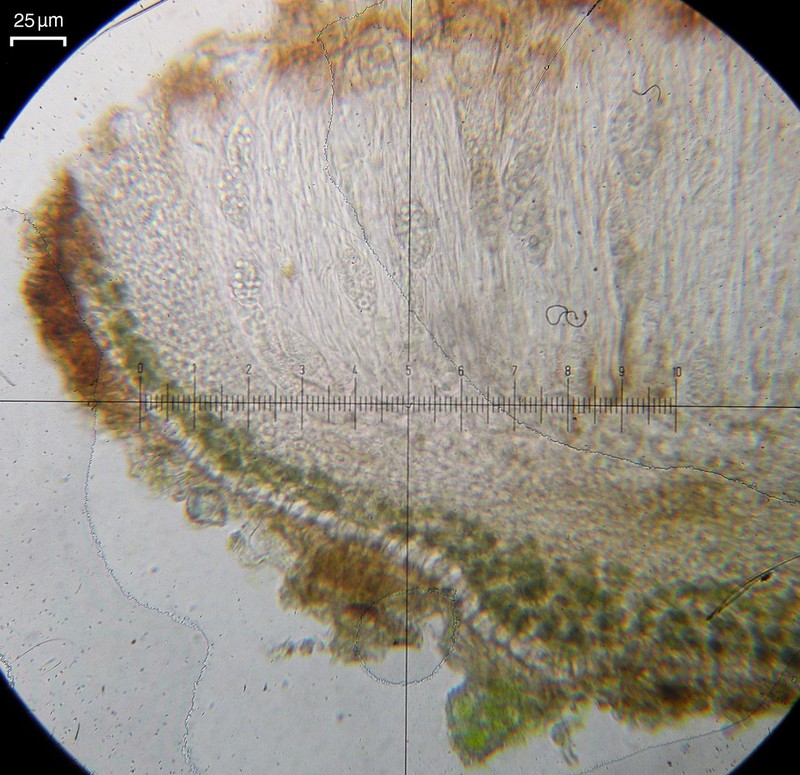 Terete Skin Lichen photo 2