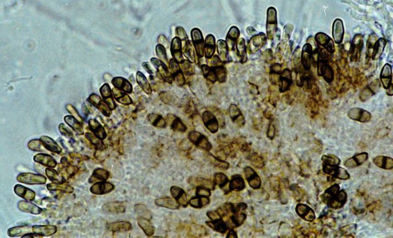 Lichenodiplis lecanorae