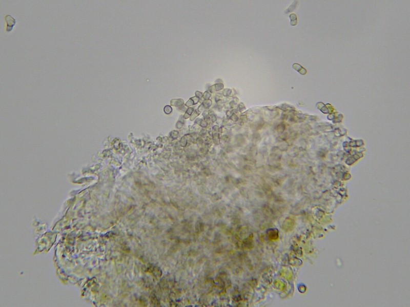 Lichenodiplis lecanorae photo 3