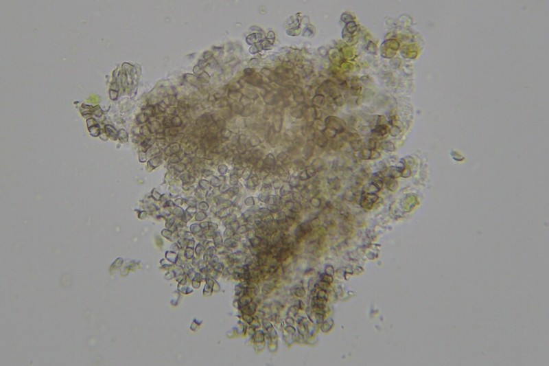Lichenodiplis lecanorae photo 5