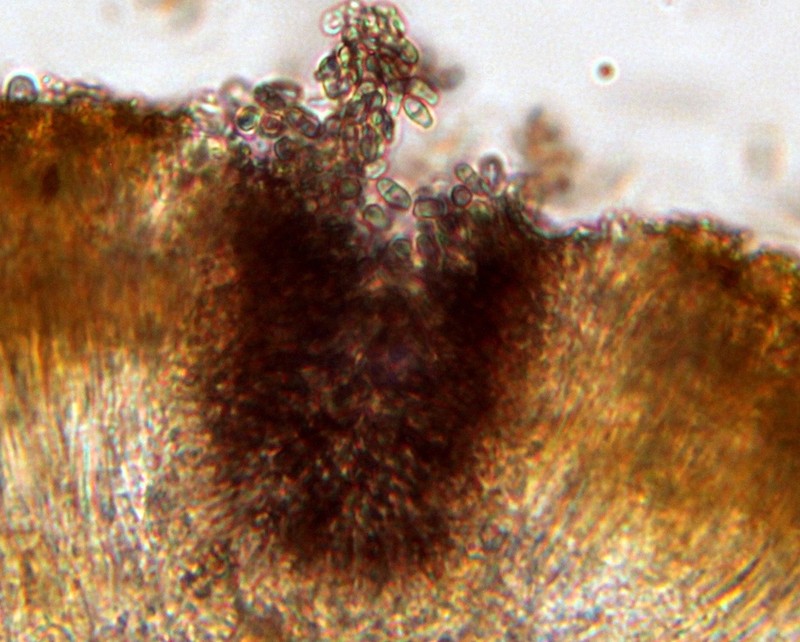 Lichenodiplis lecanorae photo 8