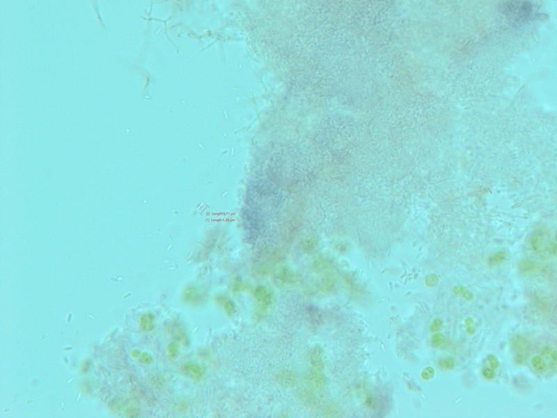 Hedlund's Dot Lichen