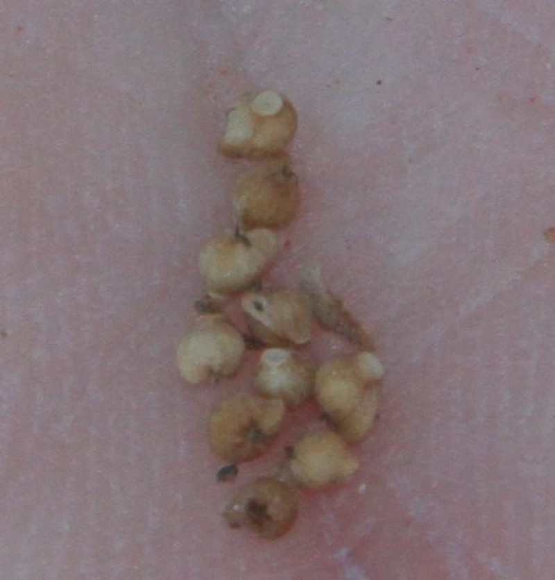 Osteocarpum acropterum var. deminutum photo 2