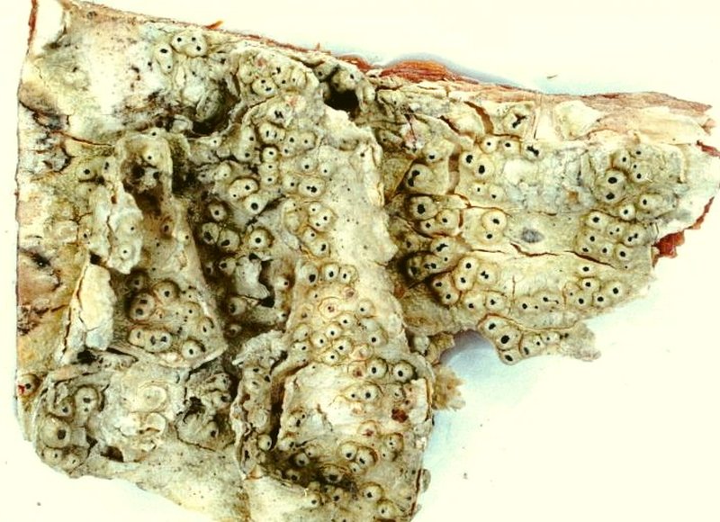 Pore Lichen
