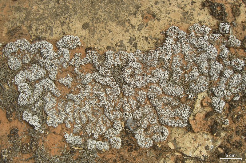 Cerebral Fishscale Lichen