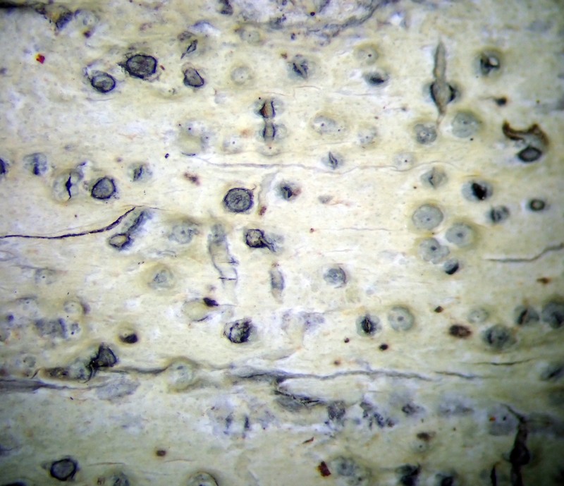 Wart Lichen photo 3