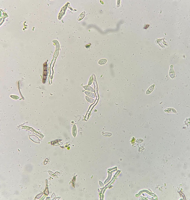 Refractohilum Lichen