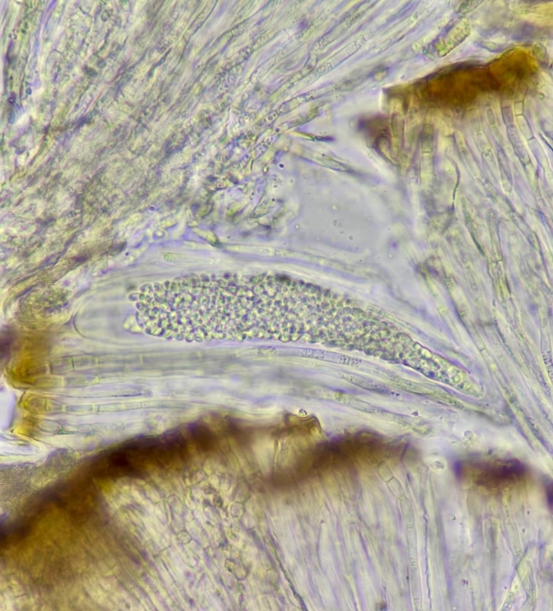 Sarcogyne Lichen