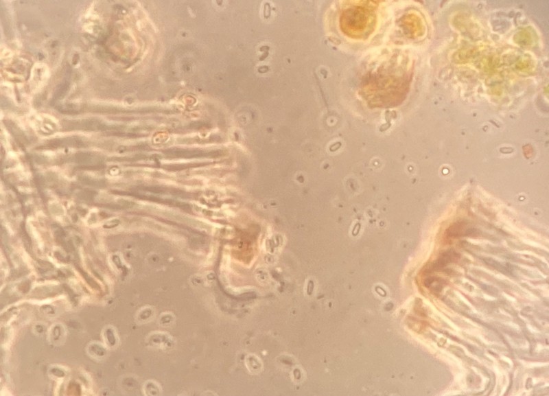 Sarcogyne Lichen photo 2