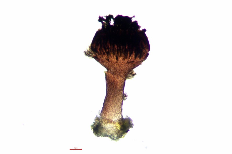 Sphinctrina Lichen photo 7