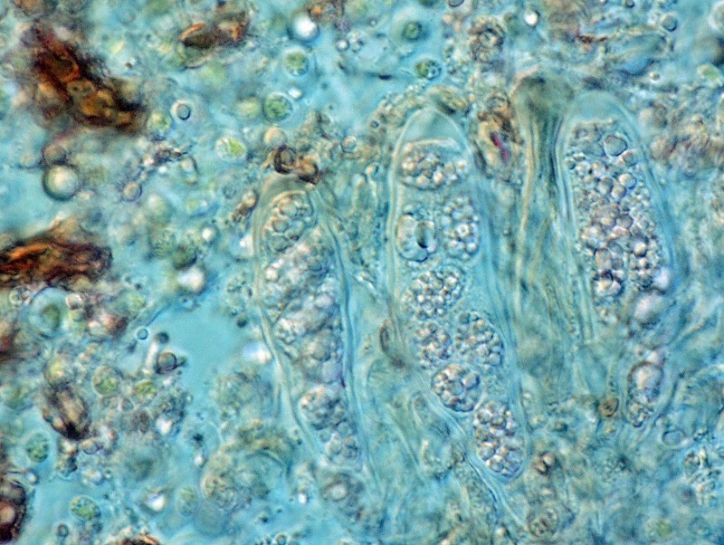 Gelatinous Trapeliopsis Lichen photo 3