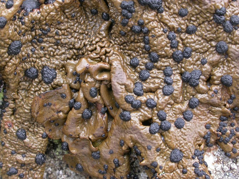Navel Lichen