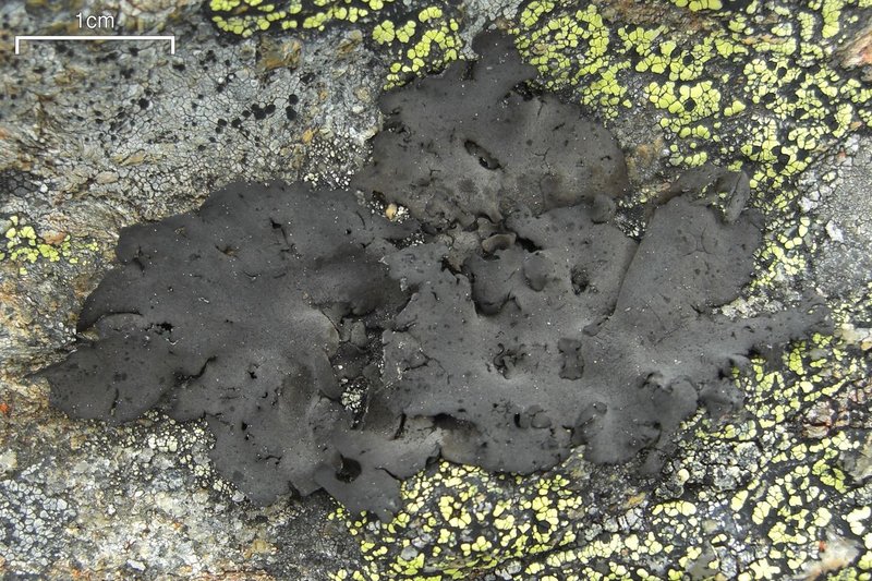 Navel Lichen