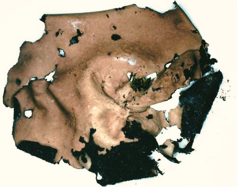 Navel Lichen photo 5