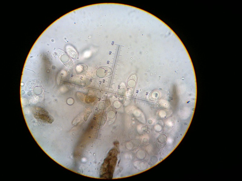 Wart Lichen photo 4