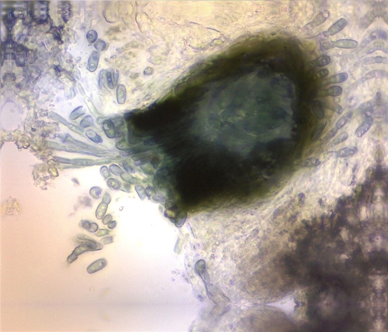 Vouauiella lichenicola photo 6